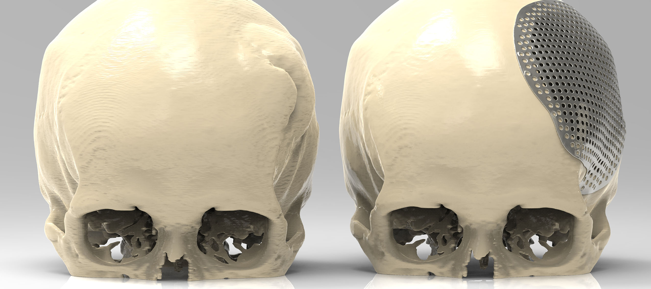 Renishaw to present the latest developments in Additive Manufacturing at ADDIT3D